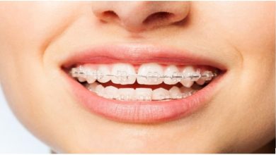 Photo of Metal Braces vs Ceramic Braces: Which One Should You Choose?